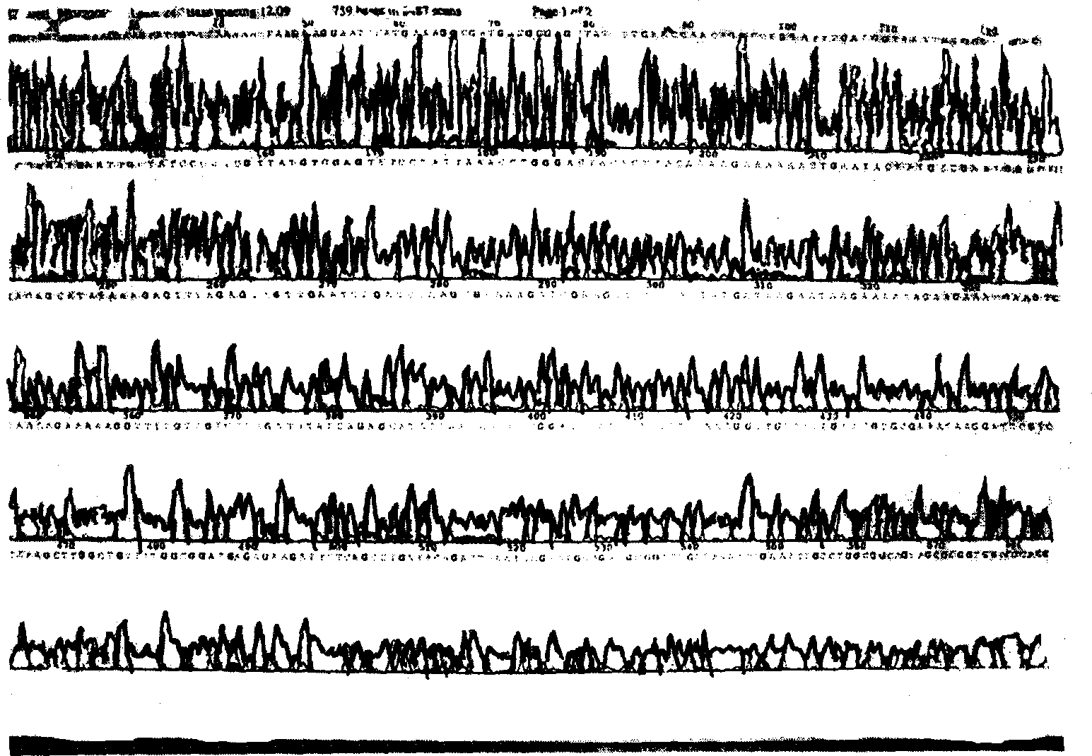 Glucose kinase derivant for inhibiting platelet aggregation and thrombase activity, and its preparing method