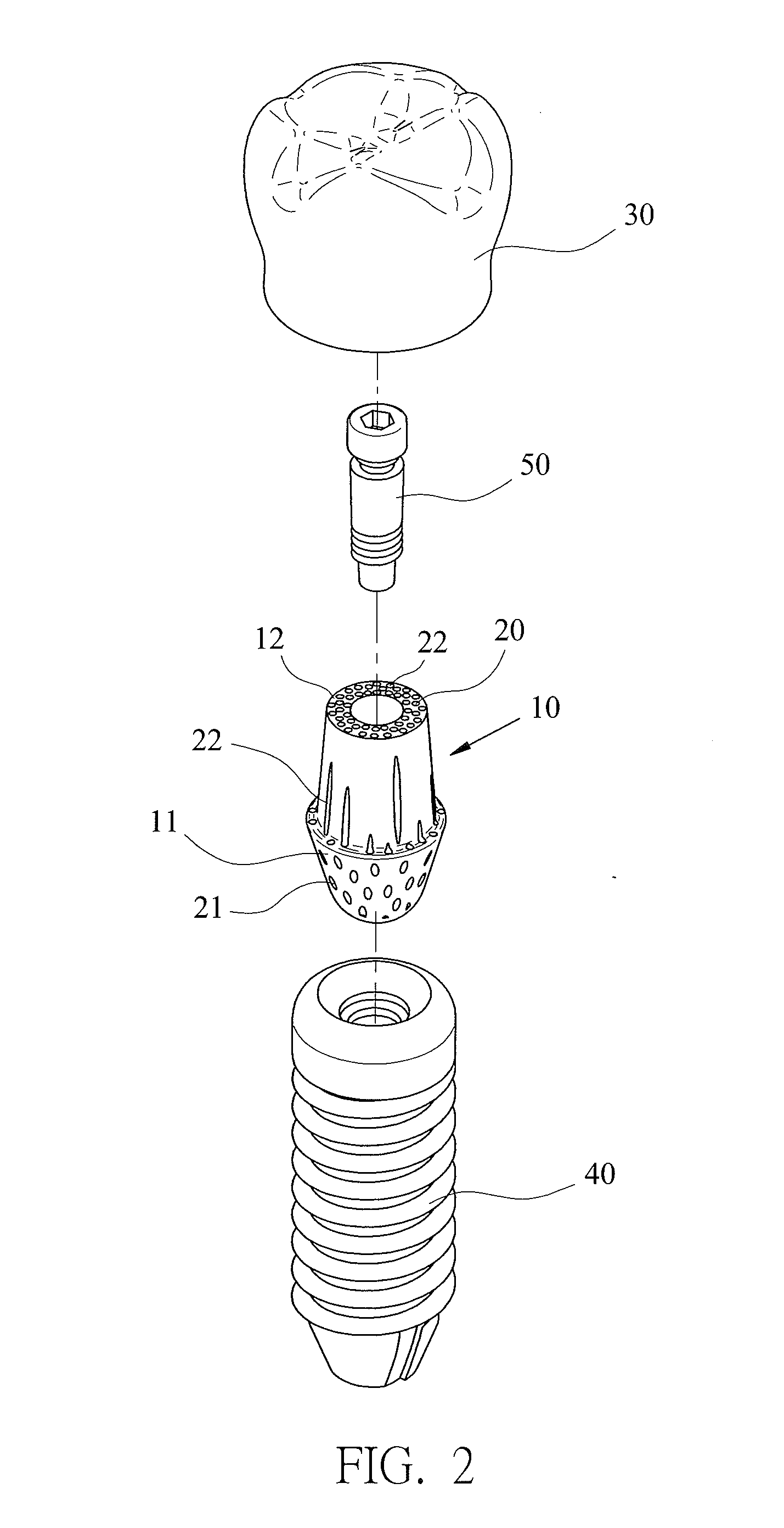 Fiber Abutment Material and Structure of Dental Implant