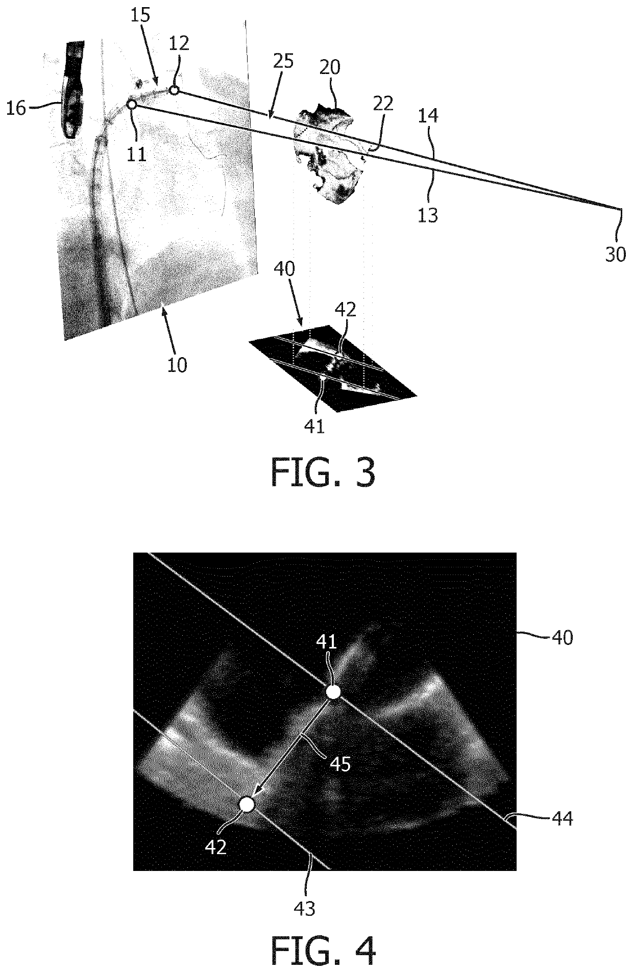 Image-based device tracking