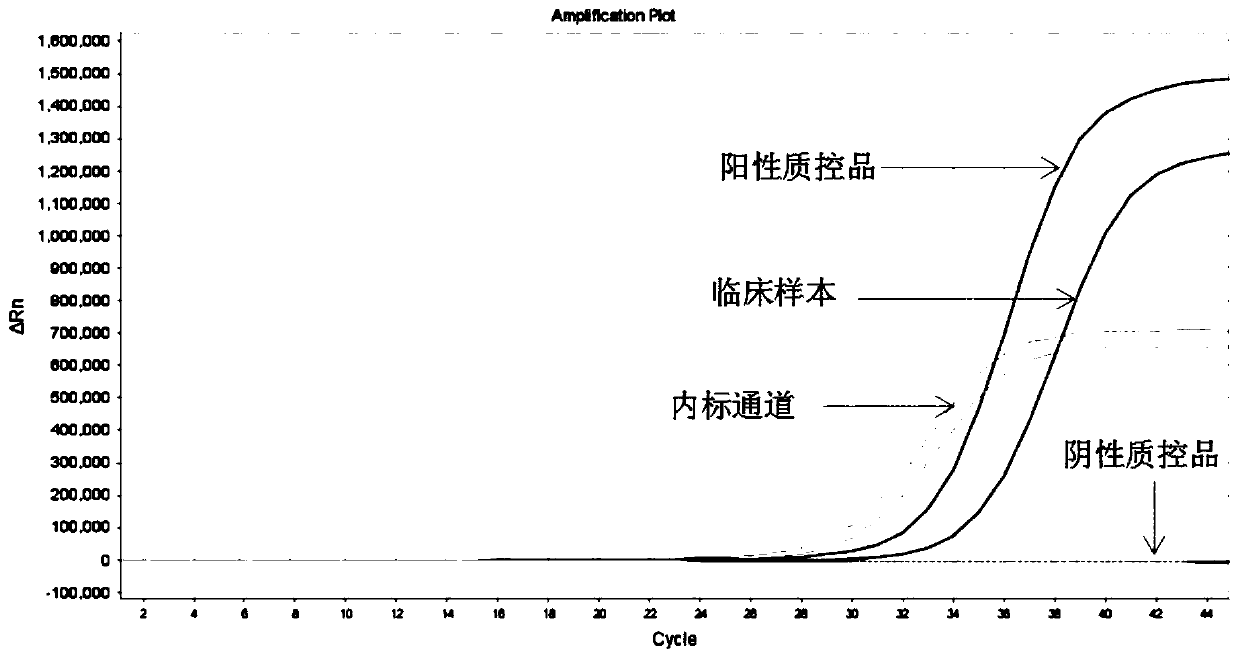 Primer probe combination and kit for detecting EGFR gene mutation