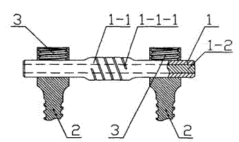 Dynamic lumbar vertebra fixing system