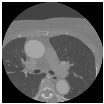 A method for adaptively generating the default window width and level of dicom images