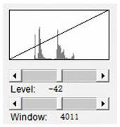 A method for adaptively generating the default window width and level of dicom images