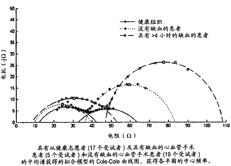 System and method for characteristic parameter estimation of gastric impedance spectra in humans