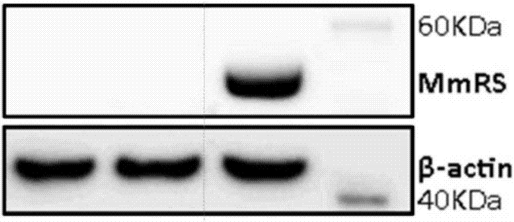 Regulation and control method of expression in chimeric antigen receptor