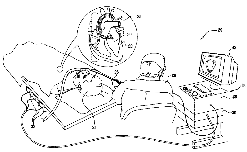 High-sensitivity pressure-sensing probe