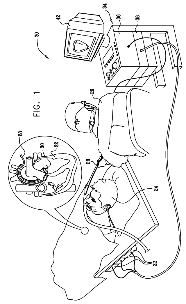 High-sensitivity pressure-sensing probe