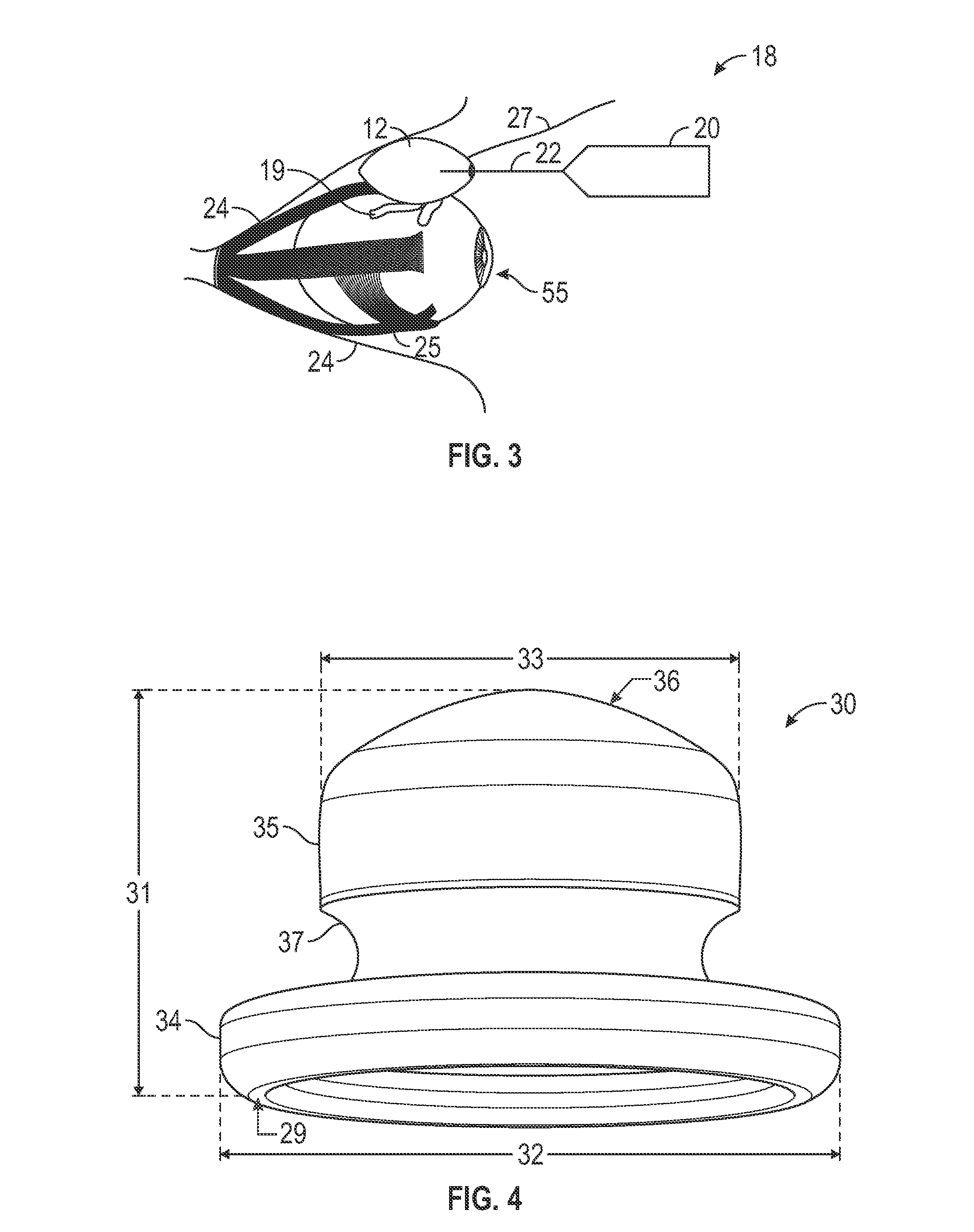 Retinal repair device and method