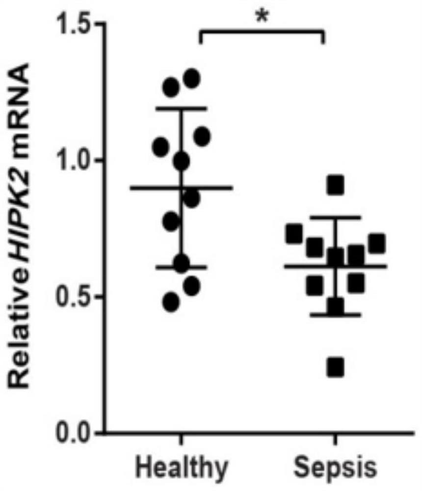 Application of HIPK2 in prediction and diagnosis of septicemia