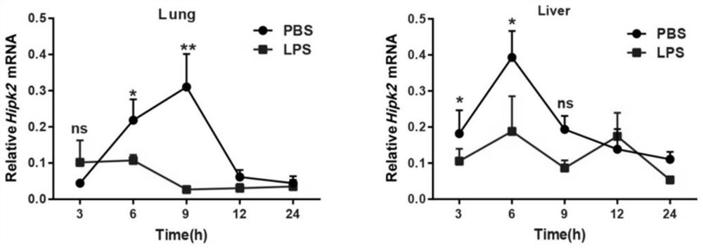 Application of HIPK2 in prediction and diagnosis of septicemia