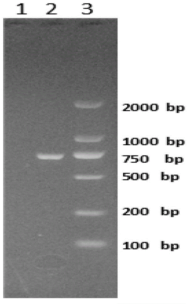 Gene detection kit for Thailand type alpha-thalassemia