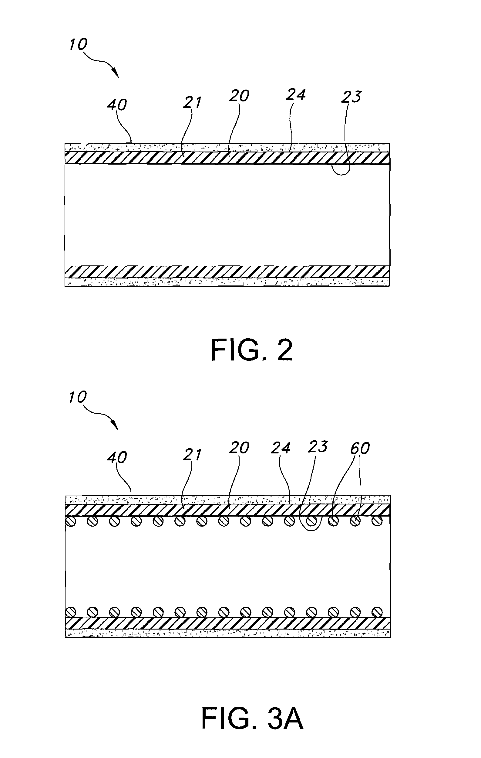 Intraluminal lining