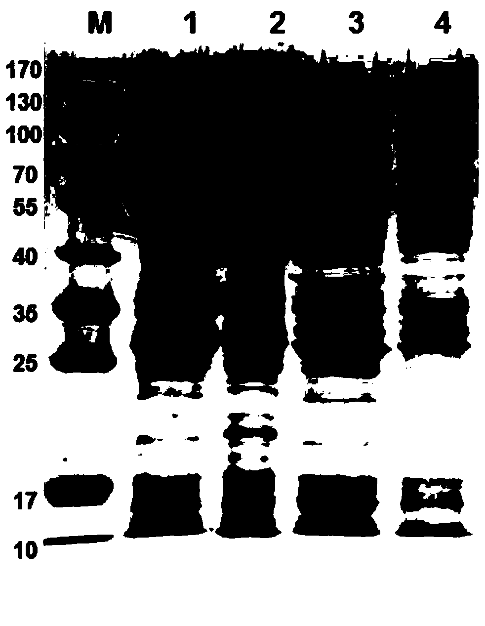 Acinetobacter baumannii 1a1s_1969 recombinant protein and its preparation method and application