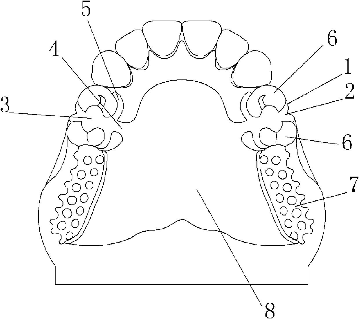 Combined short arm clasp for removable partial denture