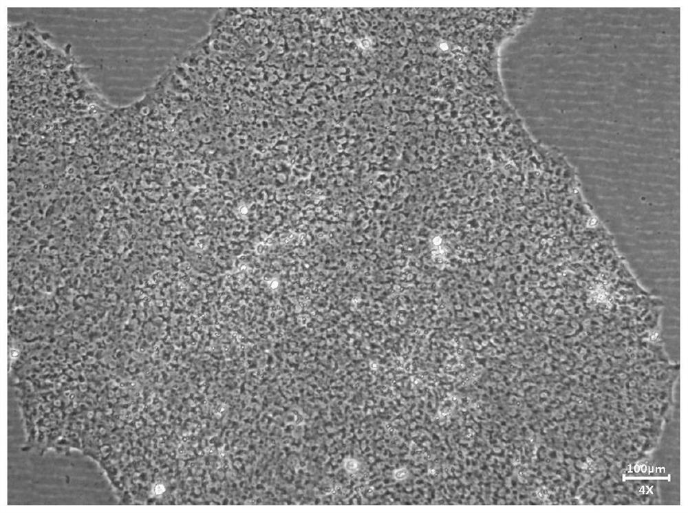 Culture solution for inducing multifunctional stem cells to differentiate into dopamine progenitor cells and differentiation method