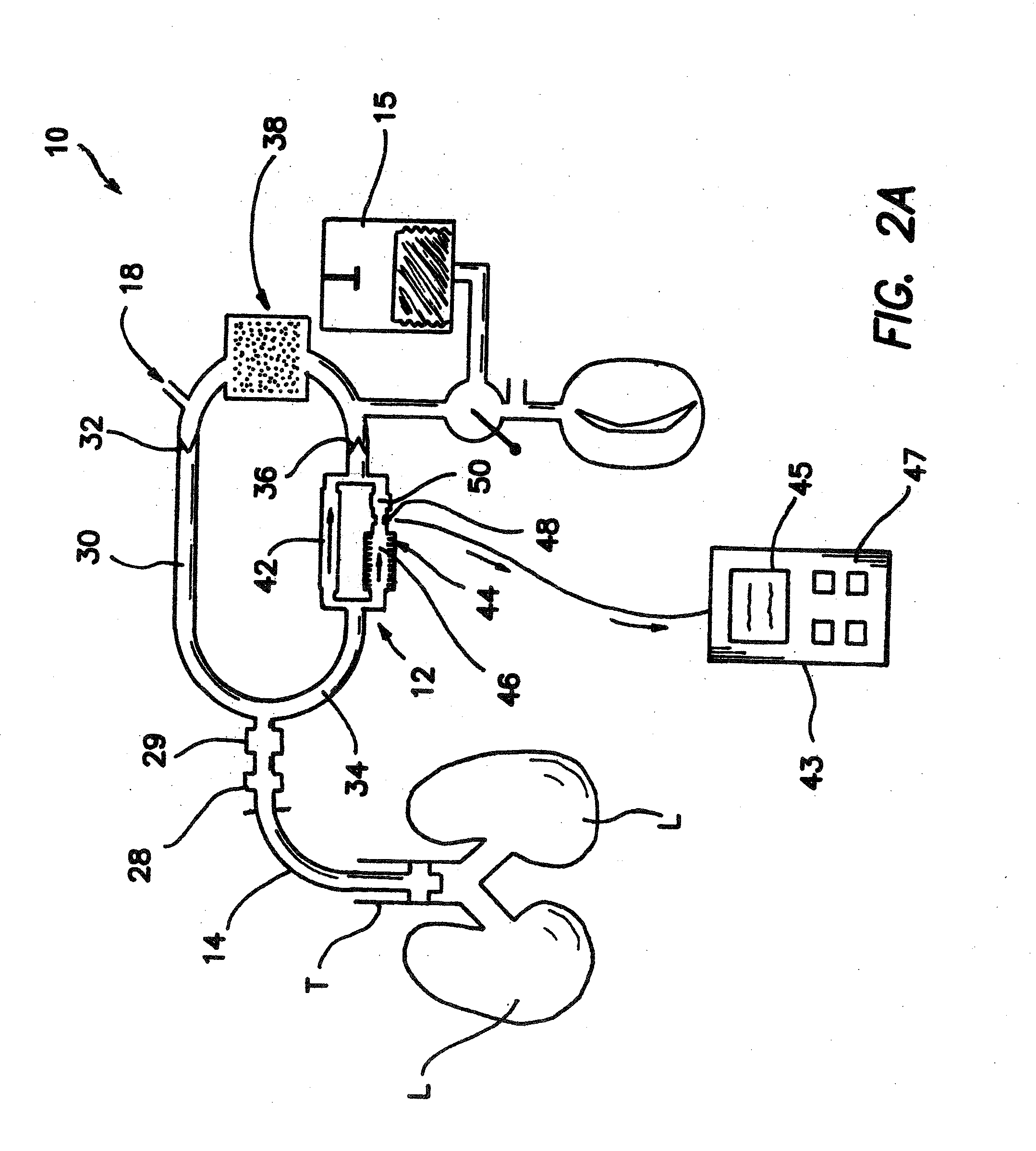 Bymixer Apparatus and Method for Fast-Response, Adjustable Measurement of Mixed Gas Fractions in Ventilation Circuits