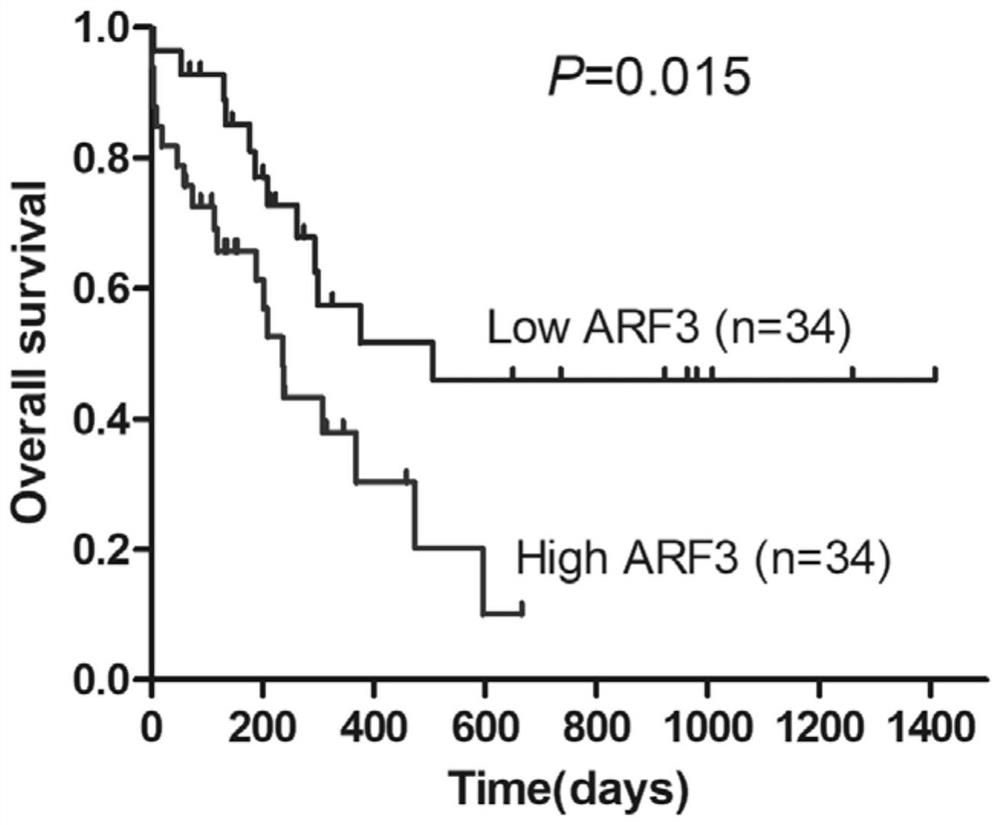 Marker for auxiliary diagnosis, prognosis diagnosis or risk stratification of acute myeloid leukemia and application thereof