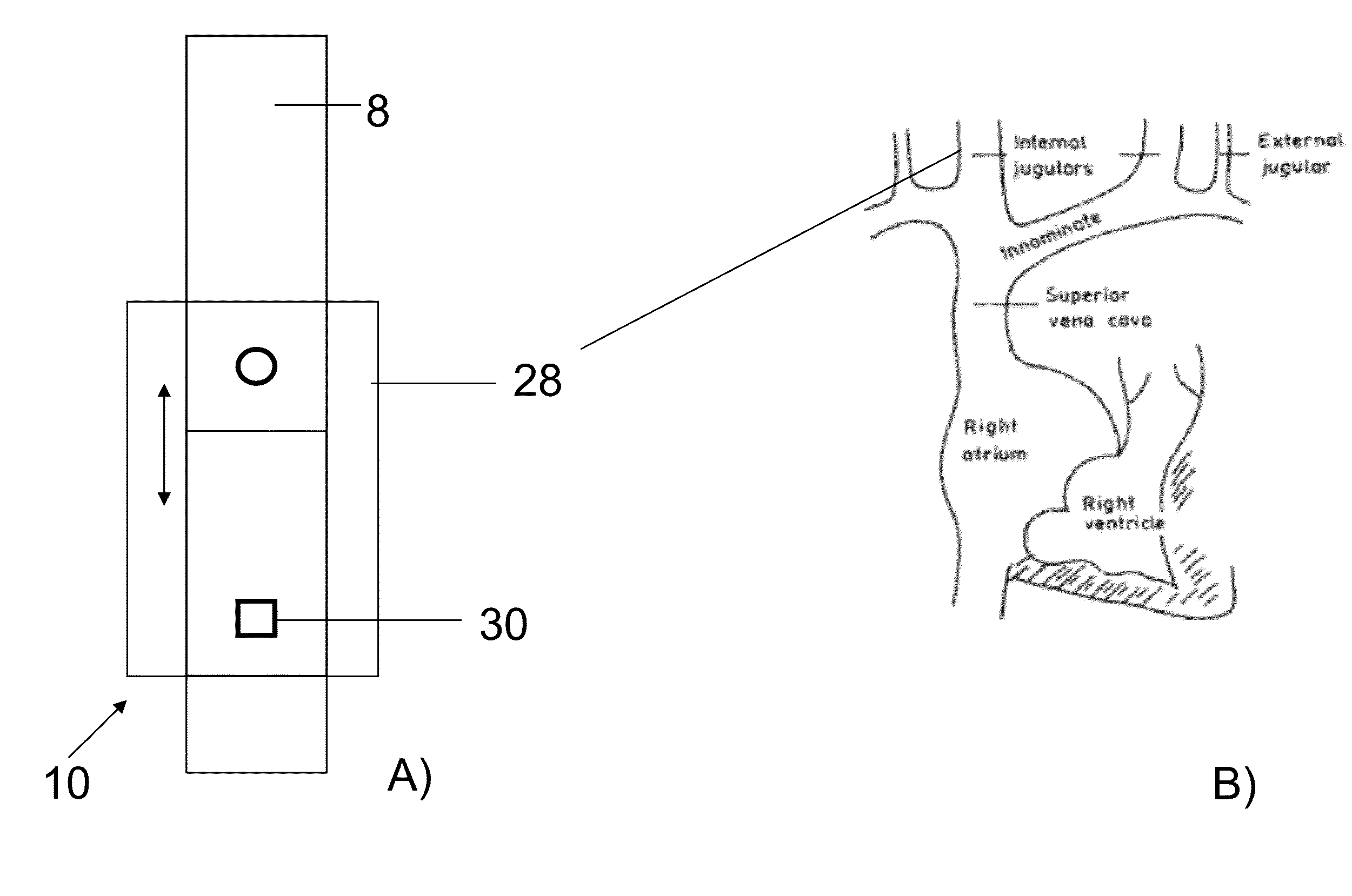 Method and device for measuring parameters of cardiac function