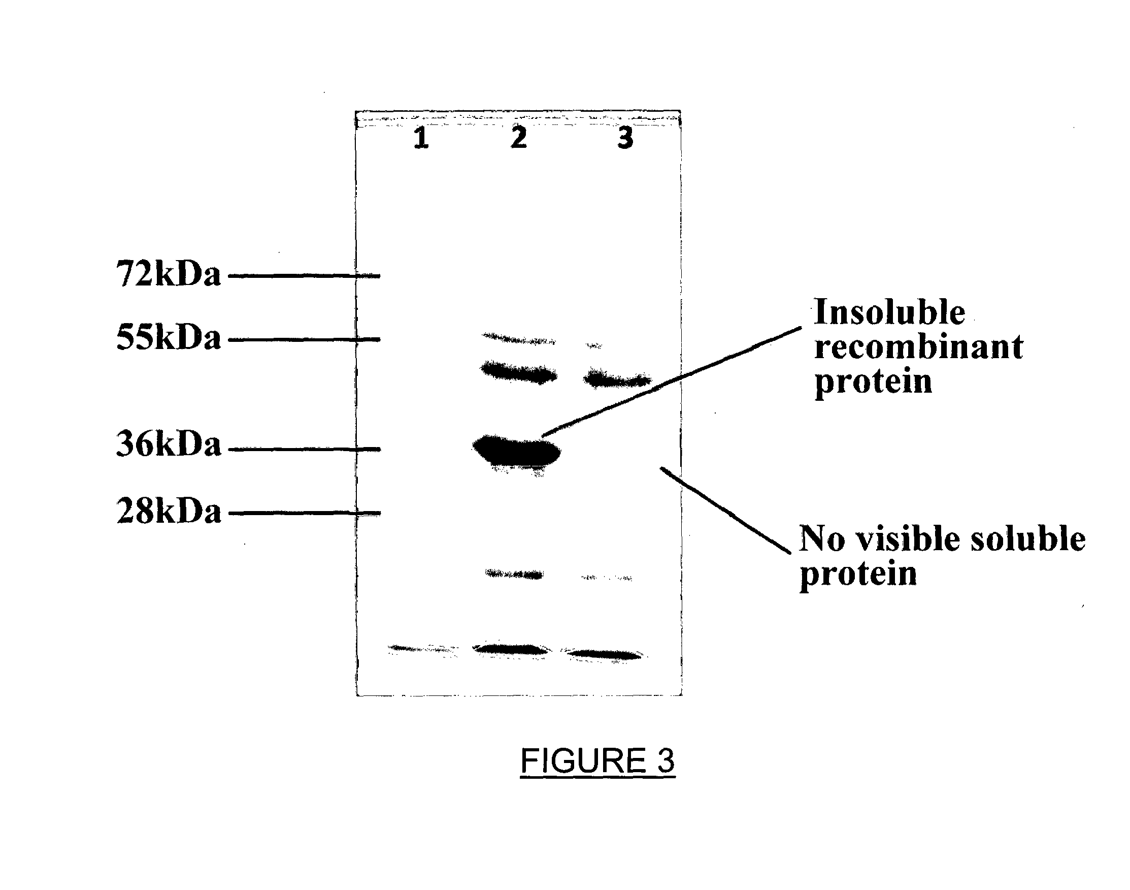 Recombinant therapeutic glycine n-acyltransferase