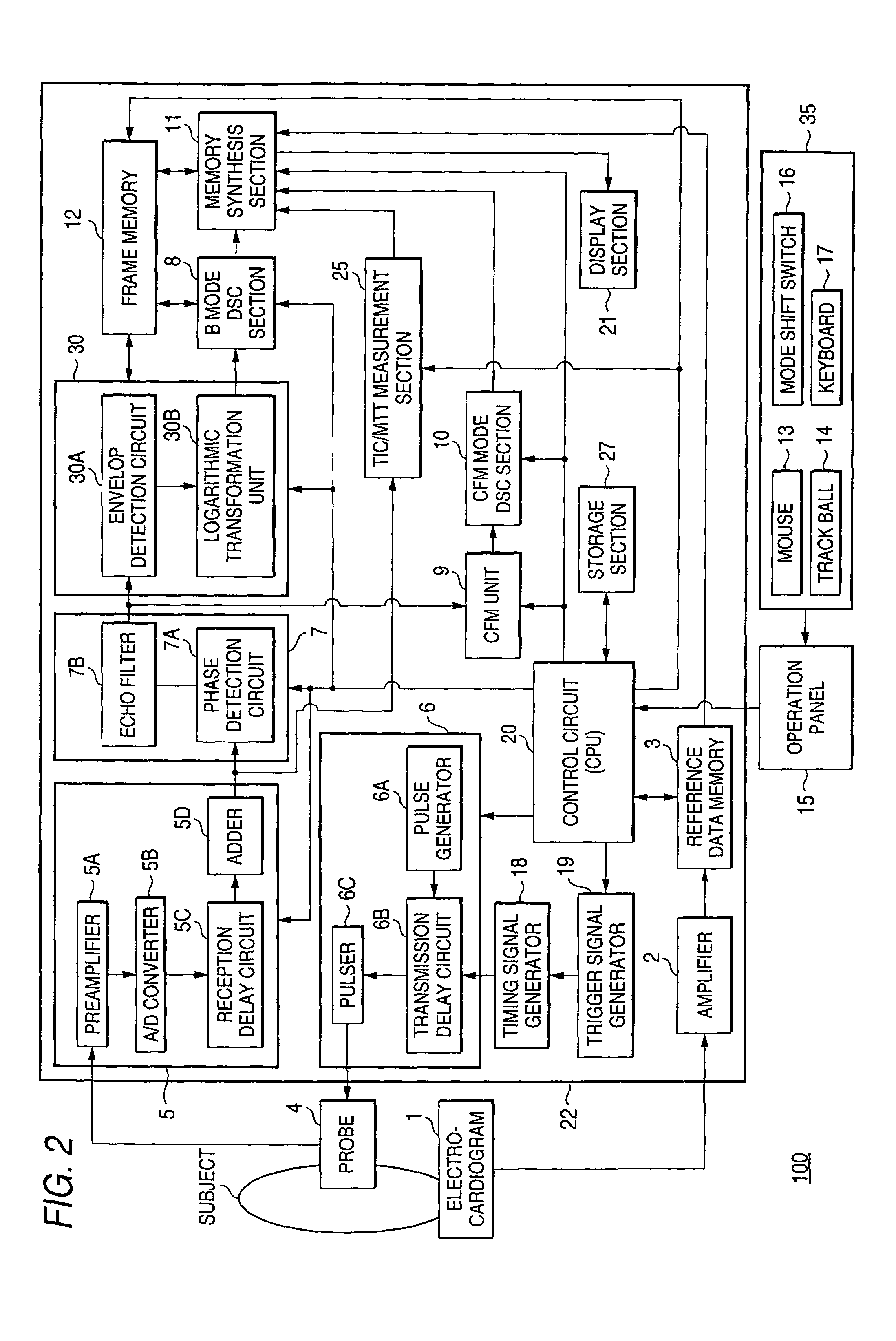 Ultrasonic diagnostic apparatus