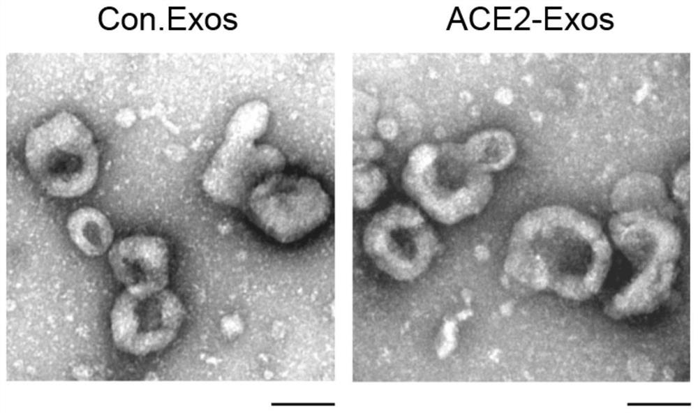 Preparation method and application of exosome for expressing ACE2 protein