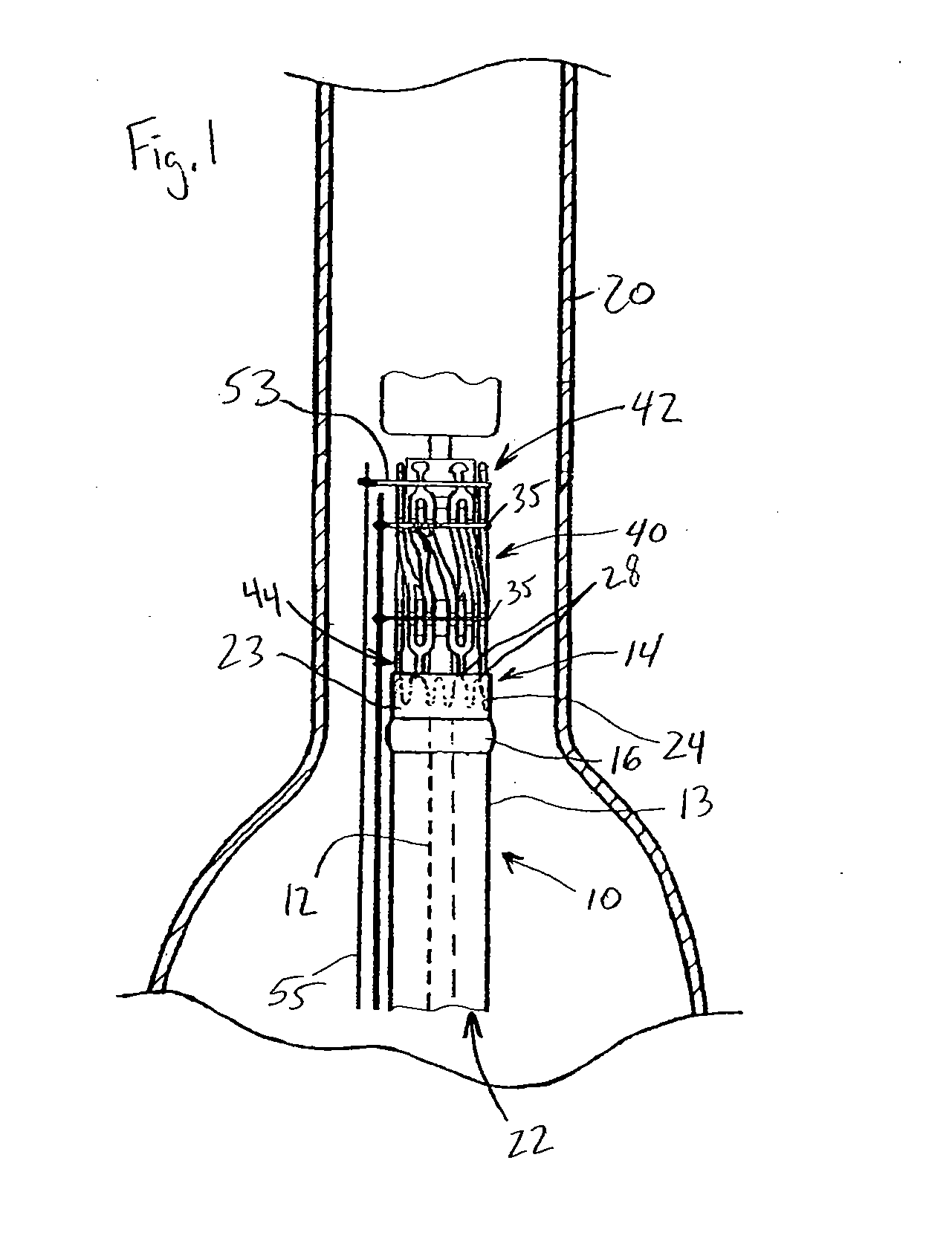 System and method of pivoted stent deployment