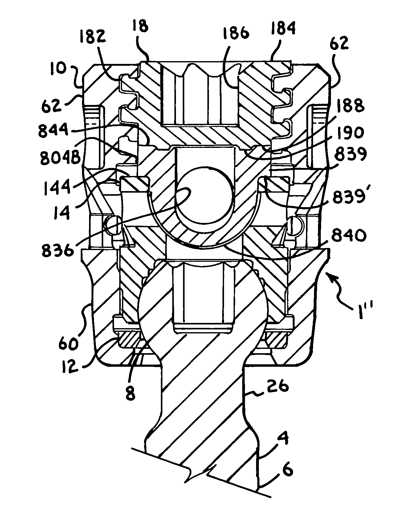 Spinal connecting members with tensioned cords and rigid sleeves for engaging compression inserts