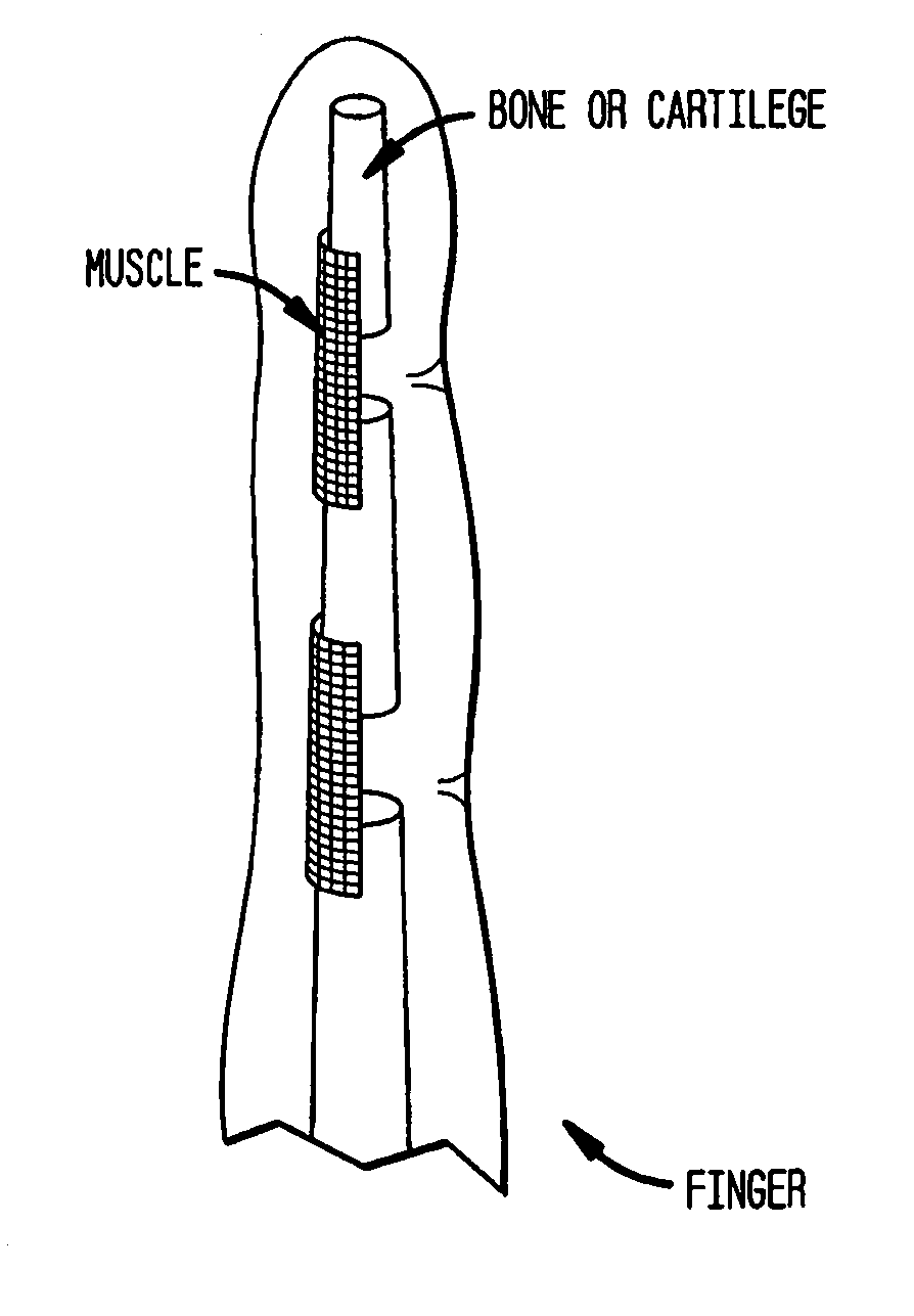 Production of tissue engineered digits and limbs