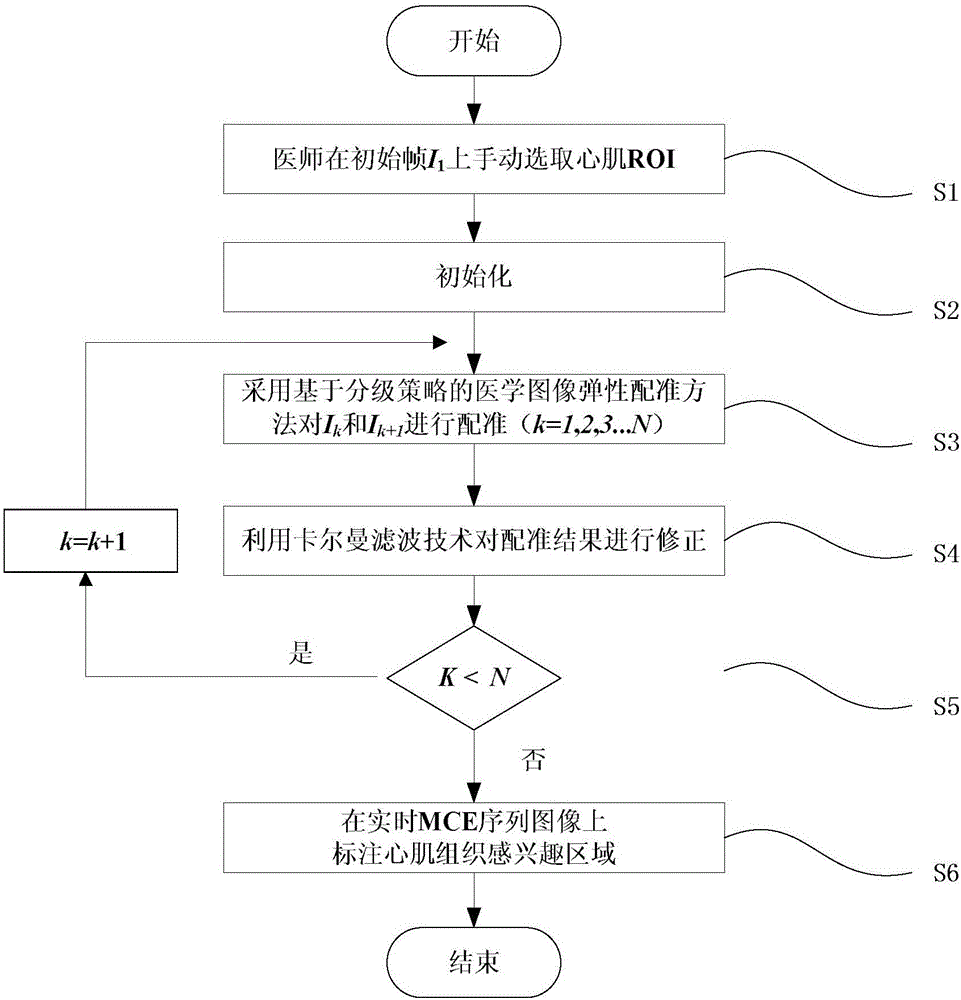 Automatic real-time MCE sequence image myocardial tissue region-of-interest tracking method