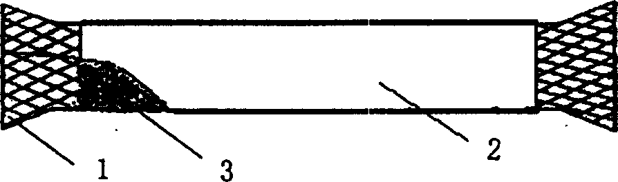 Medical internal marmem frame coated by high-molecular film for penetration therapy and its preparing process