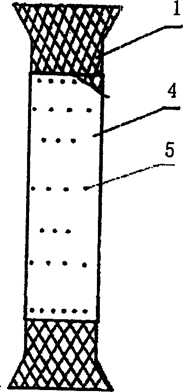 Medical internal marmem frame coated by high-molecular film for penetration therapy and its preparing process