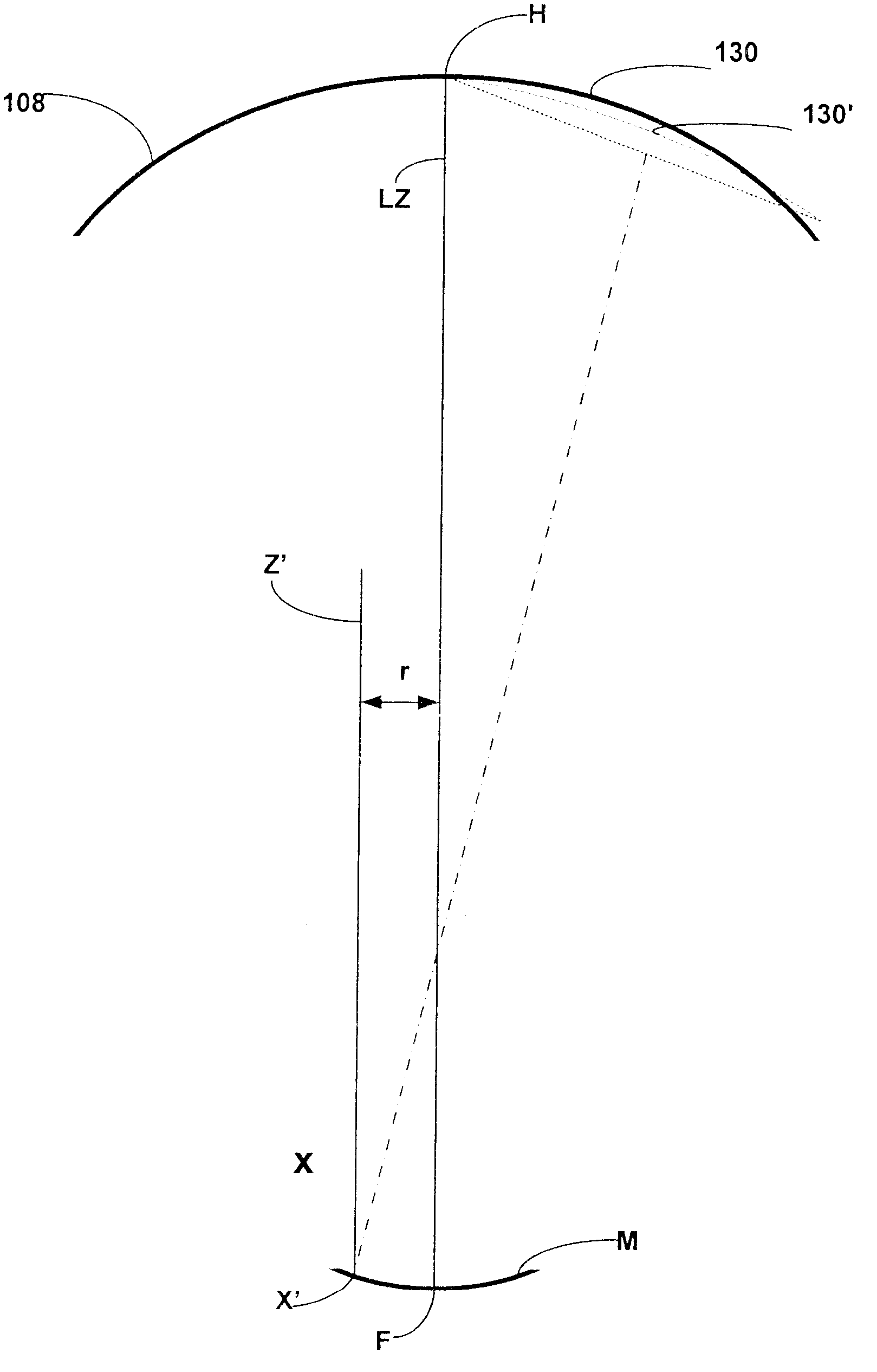 Method and apparatus for universal improvement of vision