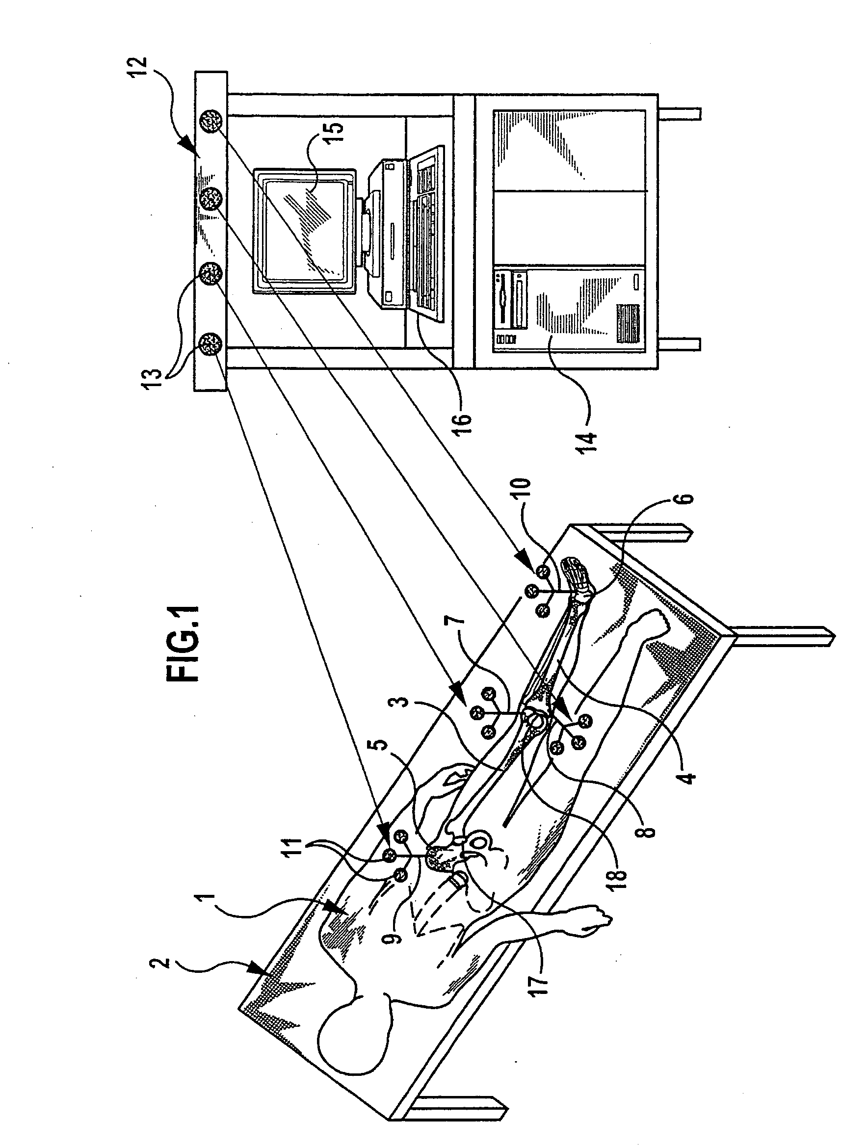 Method and device for determining the position of a knee-joint endoprosthesis