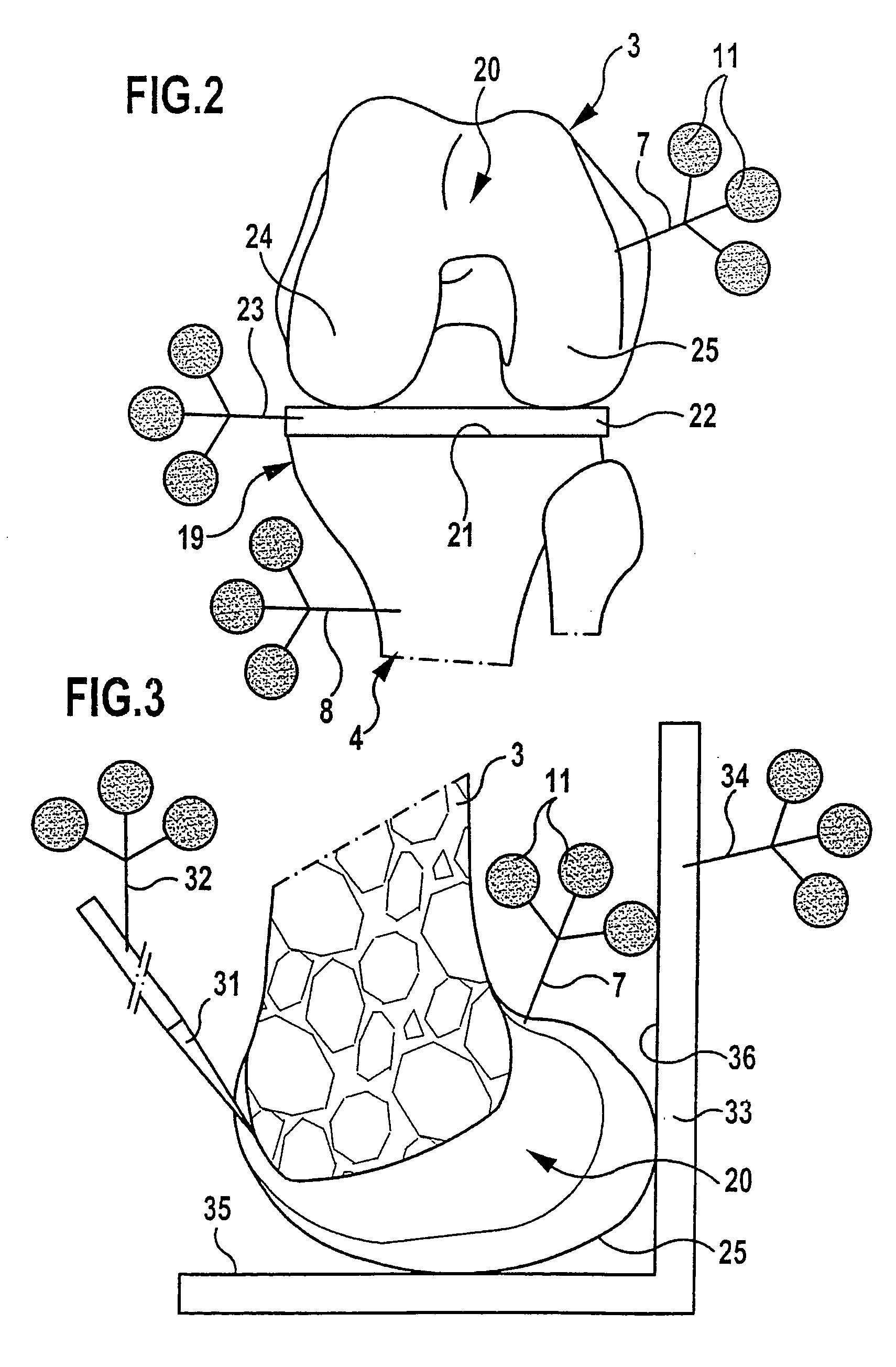 Method and device for determining the position of a knee-joint endoprosthesis