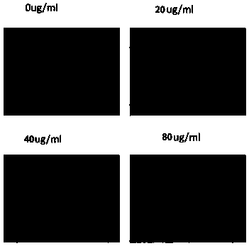 Novel recombinant bee venom polypeptide as well as preparation method and application thereof