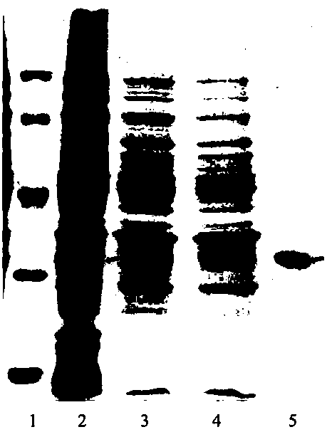 A method for increasing the expression level of soluble recombinant prokinein 2β in Escherichia coli