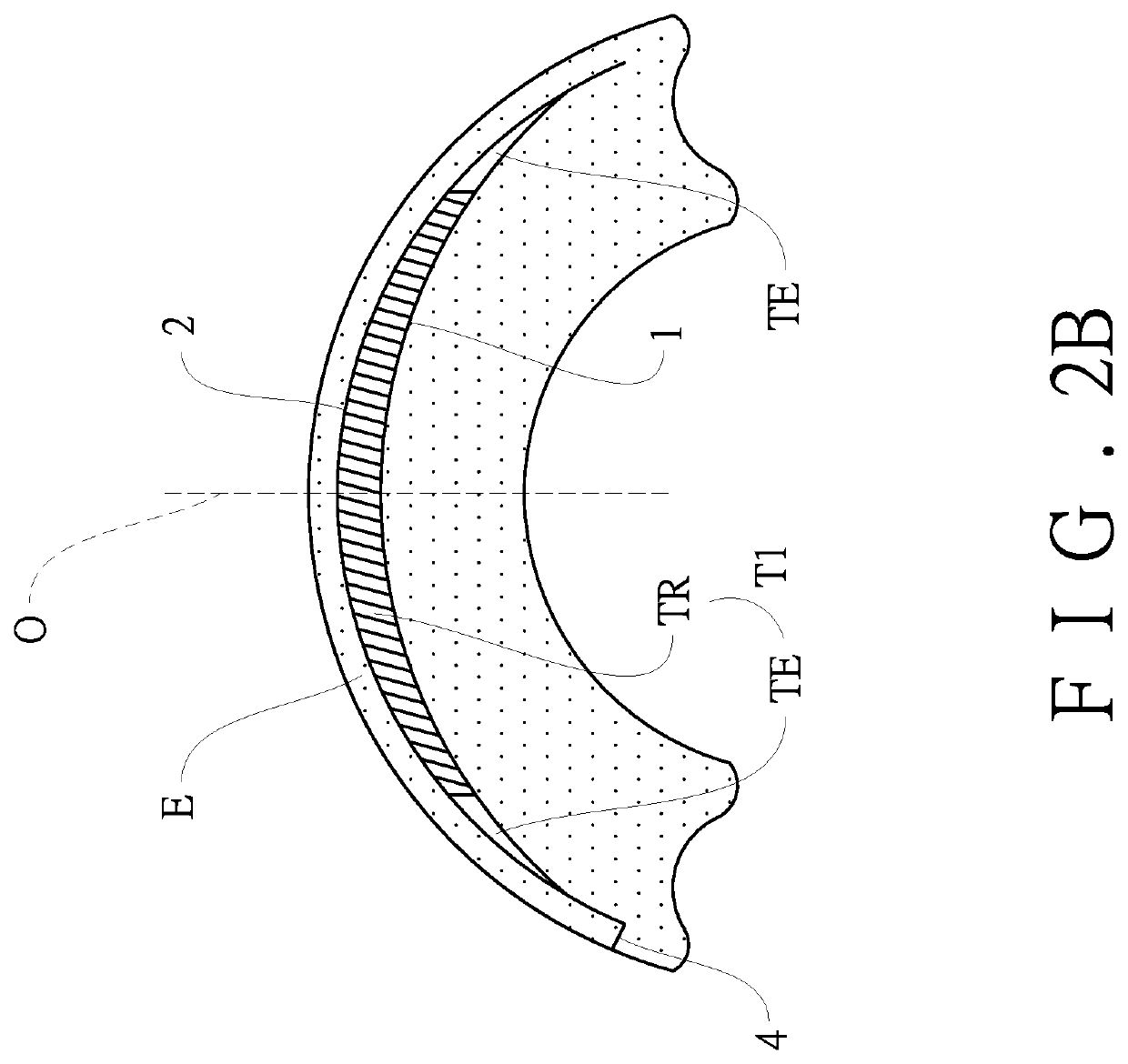 Method and apparatus for treating ocular tissue