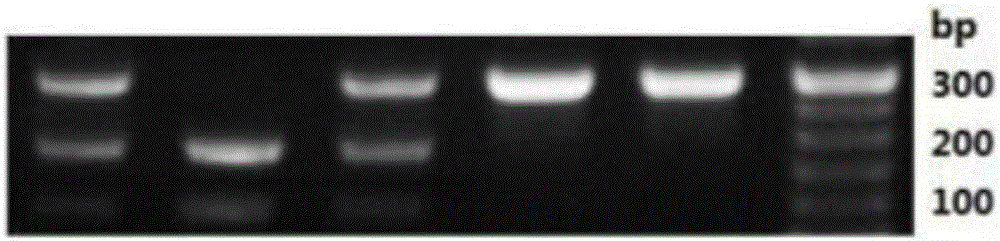 Amplification primer for detecting polymorphism of children's calcium absorption genes and application of amplification primer