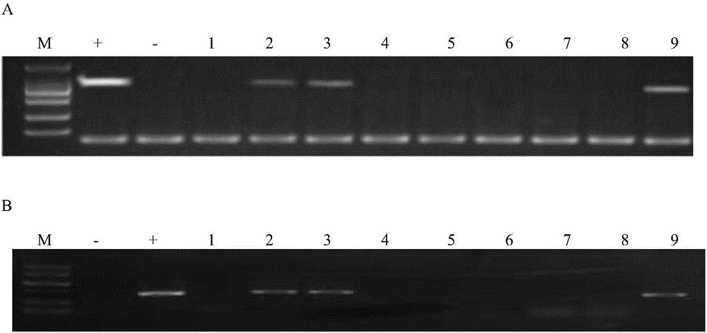 DNA molecule for expressive inhibition of hairpin RNA of Sitobion avenae chitin synthetase 1 gene and application thereof