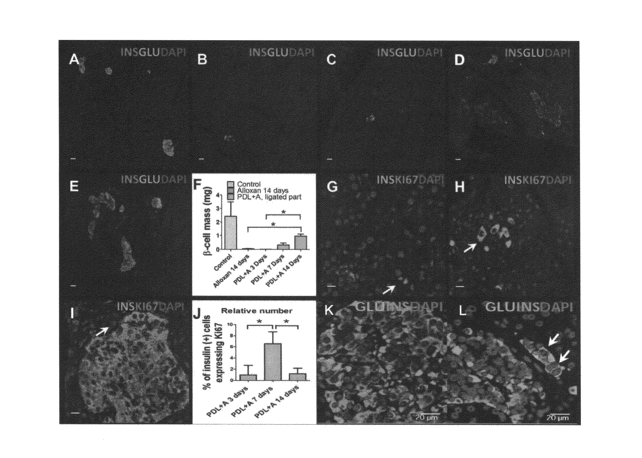 Methods of Pancreatic Beta Cell Regeneration