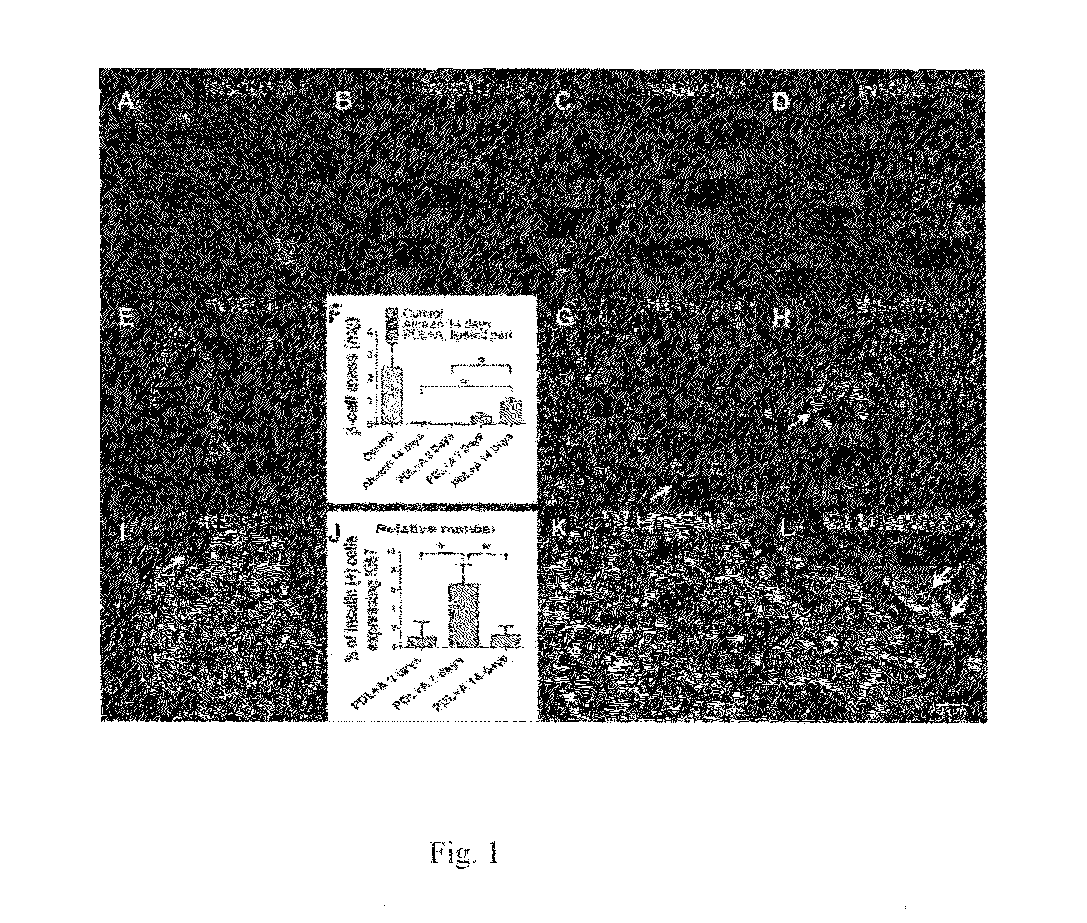 Methods of Pancreatic Beta Cell Regeneration