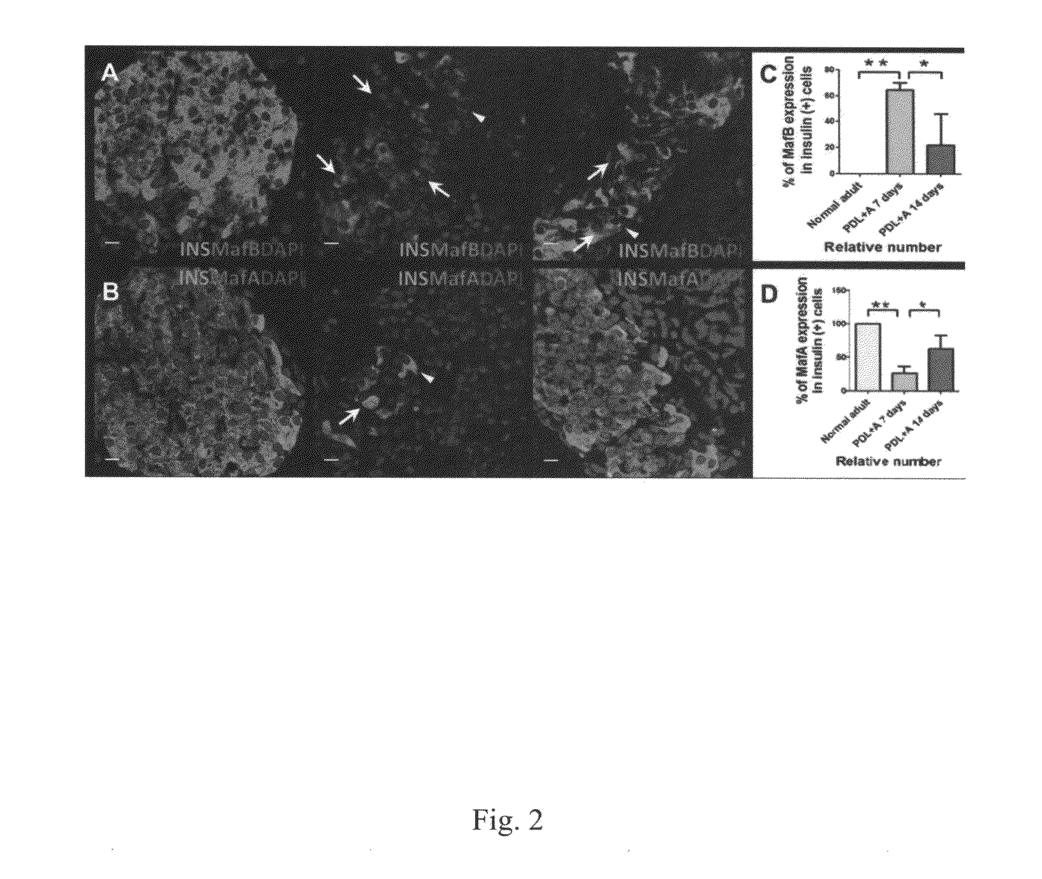 Methods of Pancreatic Beta Cell Regeneration