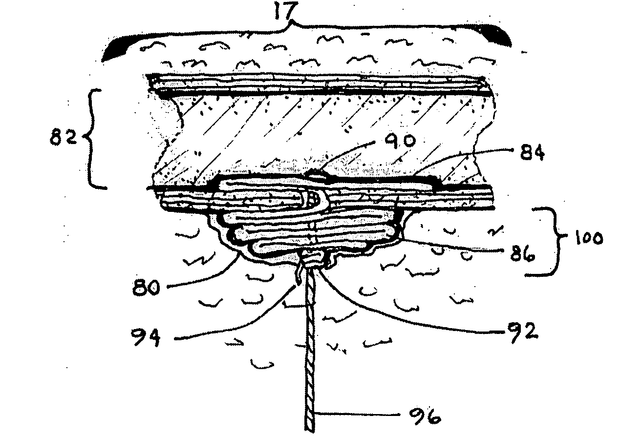 Closure medical device