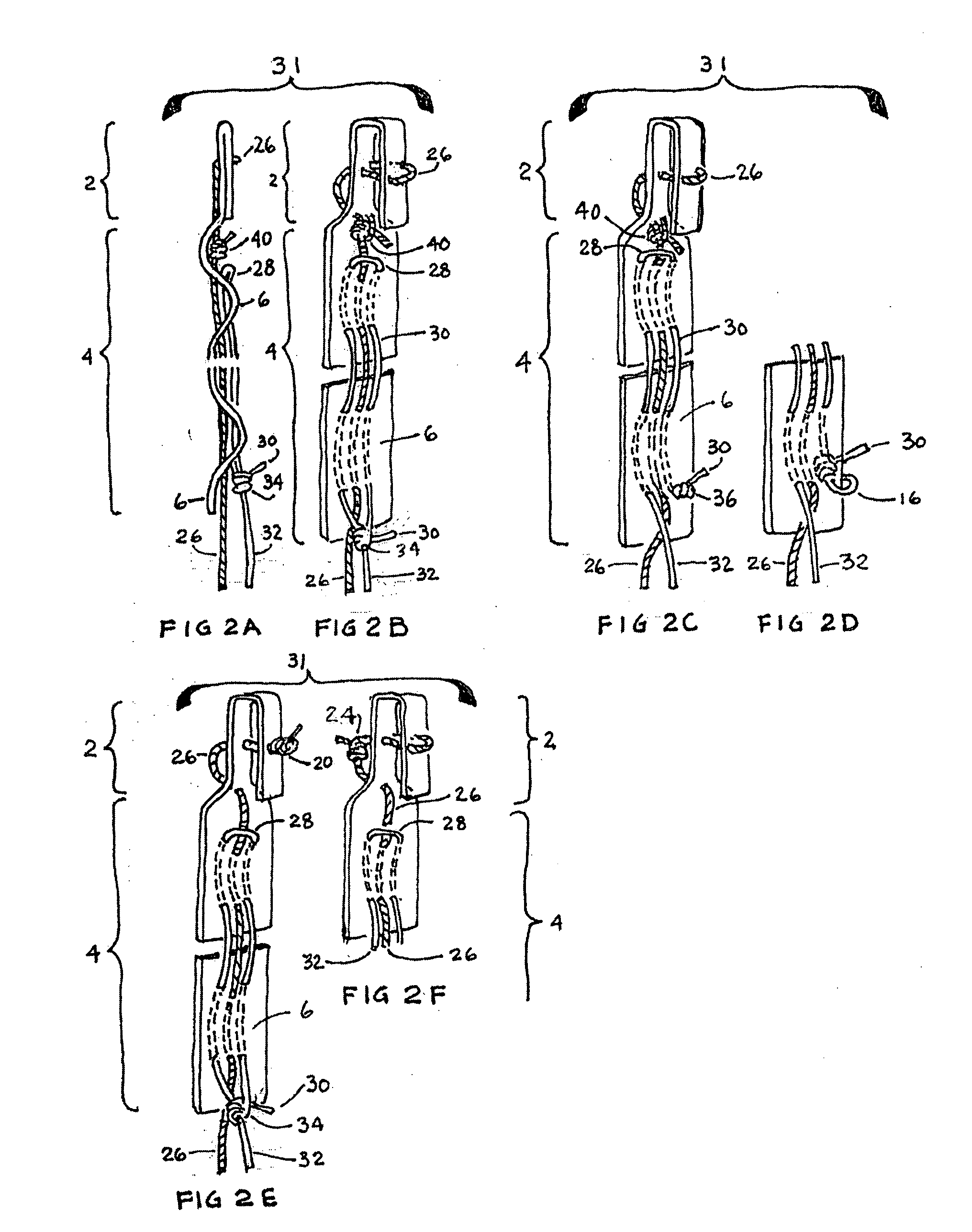 Closure medical device