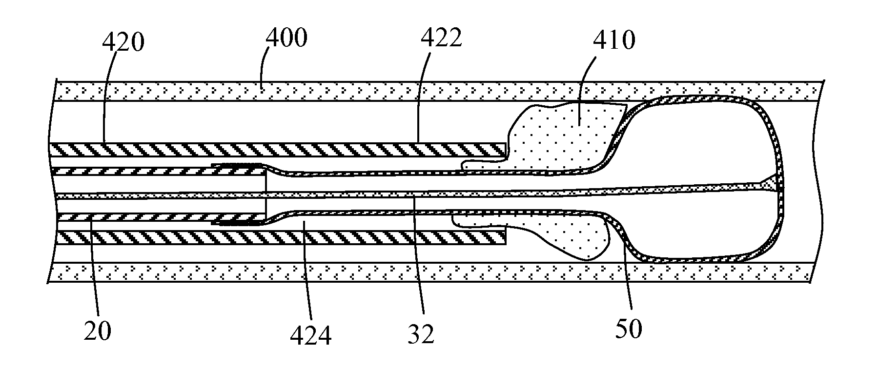 Methods and systems for performing thrombectomy procedures