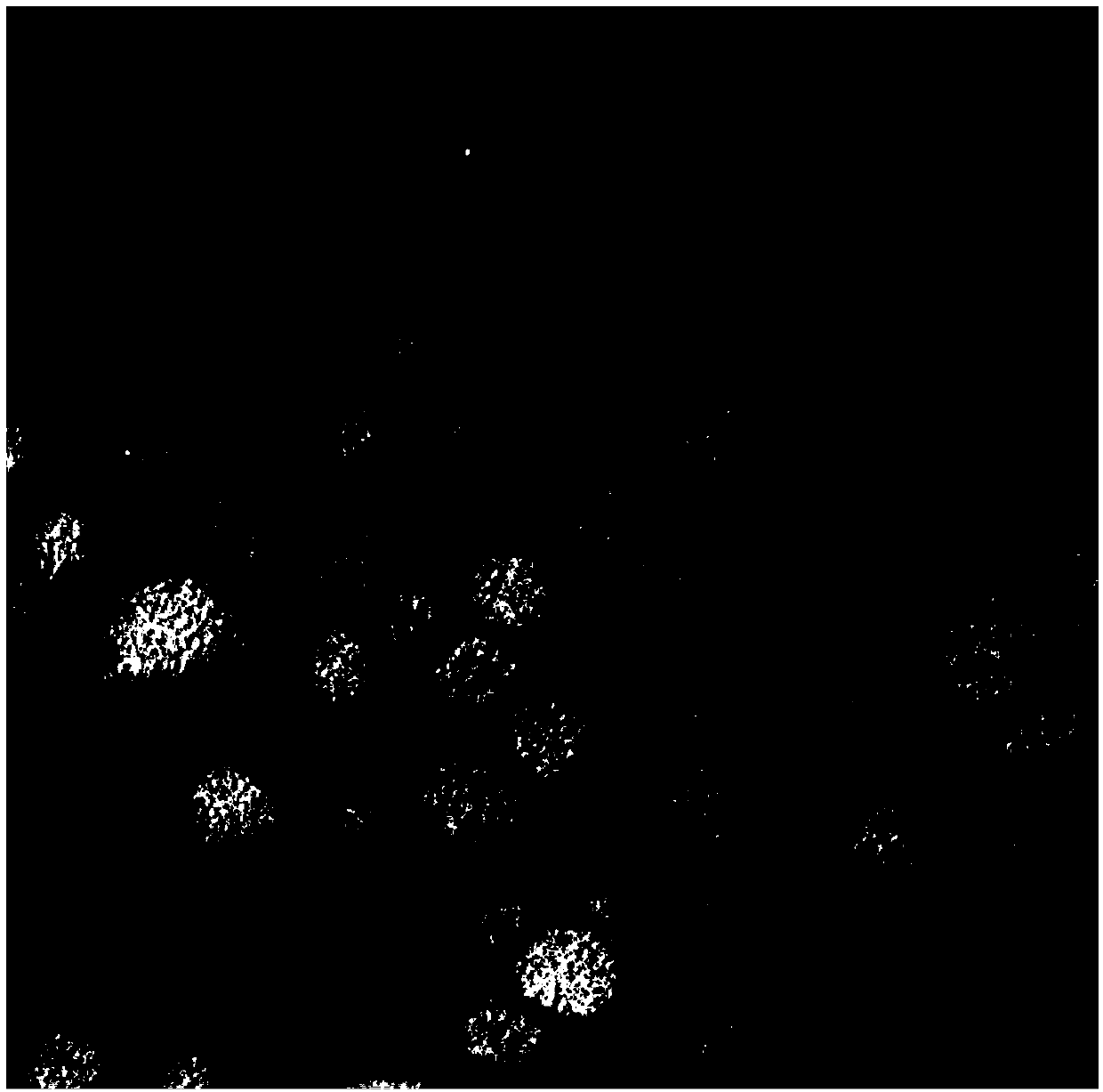 Ampelopsin grossedentata total flavonoid solid lipid nanoparticle and preparation method