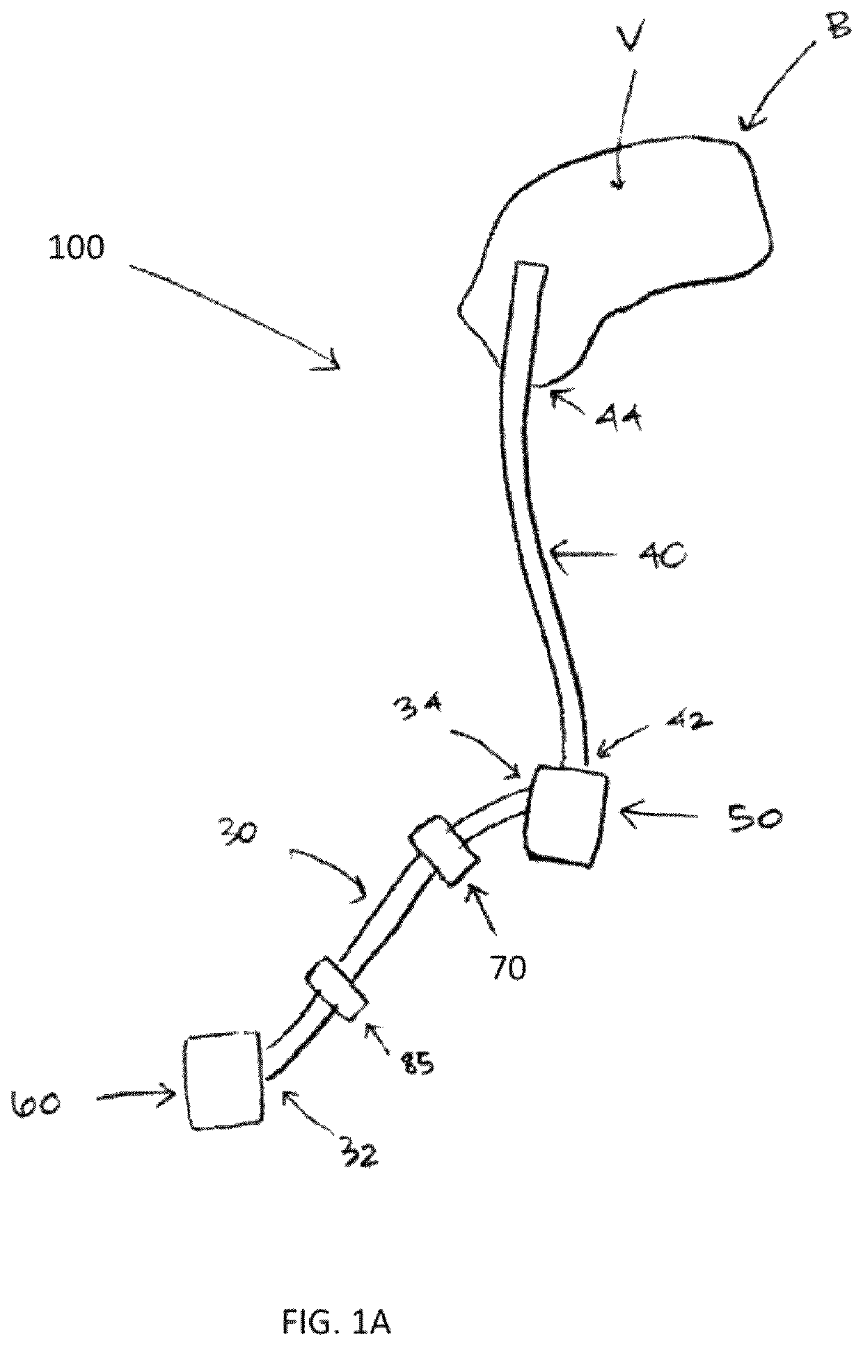 Therapeutic applications of artificial cerebrospinal fluid and tools provided therefor