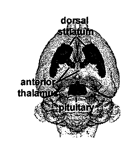 Imaging neuroleptic compounds