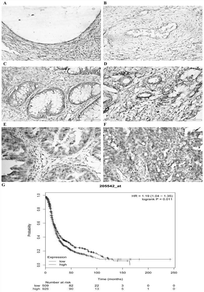 Application of Steap1 in the diagnosis, treatment and prognosis of ovarian cancer