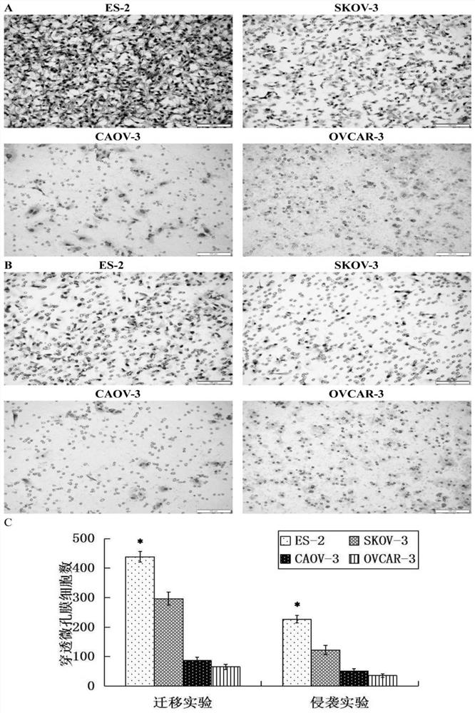 Application of Steap1 in the diagnosis, treatment and prognosis of ovarian cancer